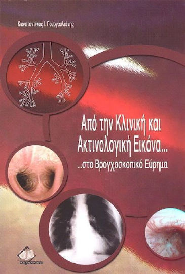 Από την κλινική και ακτινολογική εικόνα ...στο βρογχοσκοπικό εύρημα