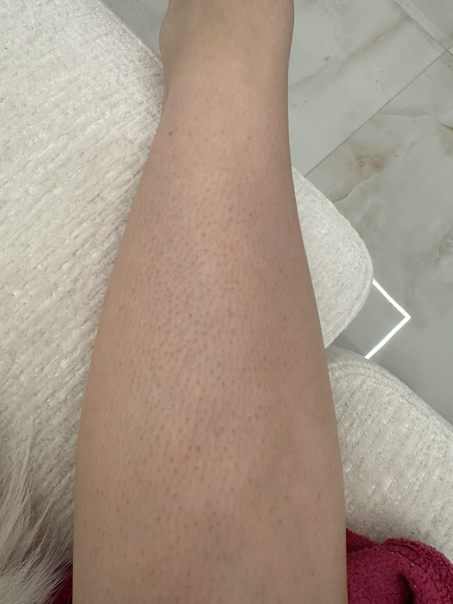 CeraVe SA Smoothing Cream Κρέμα Σώματος Ανάπλασης με Ουρία για Ξηρές/Πολύ Ξηρές Επιδερμίδες 340gr