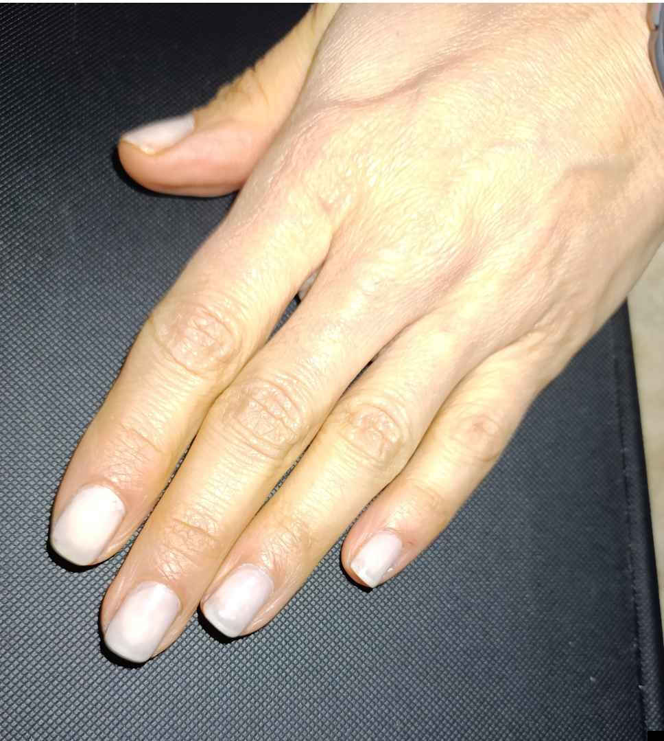 Podia Nails Intensive-Care Serum Σκληρυντικό με Βιταμίνες 10ml