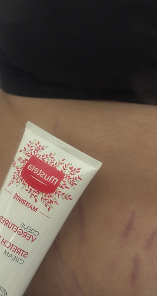 Mustela Maternite Stretch Marks Cream for Prevention & Treatment of Pregnancy Stretch Marks 150ml