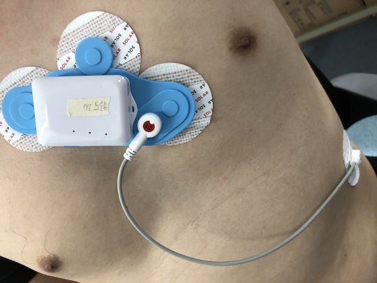 Borsam ECG Patch Holter Ρυθμού 3 Απαγωγών