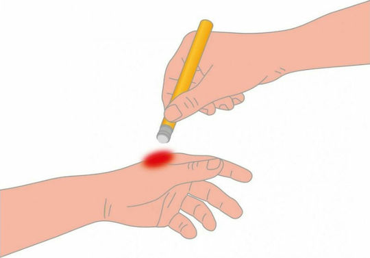 Lampa After Bite Λοσιόν για Μετά το Τσίμπημα σε Roll On/Stick 16ml