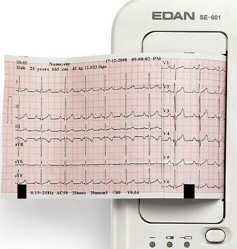 Edan SE-601B Καρδιογράφος 6-Κάναλος