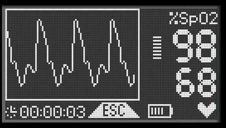 MIR Spirometer Spirodoc