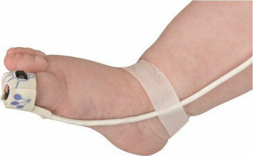 Nonin Oximetrie-Sensor 8001J 25 Flexiwrap Neugeborene