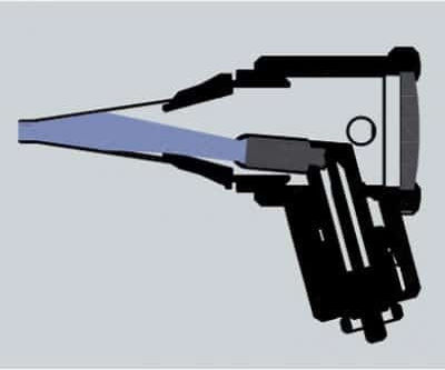 Riester Ri-Scope L1 Ωτοσκόπιο