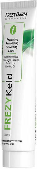 Frezyderm Frezykeld Κρέμα για Ουλές 40ml