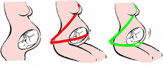 BeSafe Pregnancy Seat Belt Adjuster iZi Up & Fix with Isofix Black