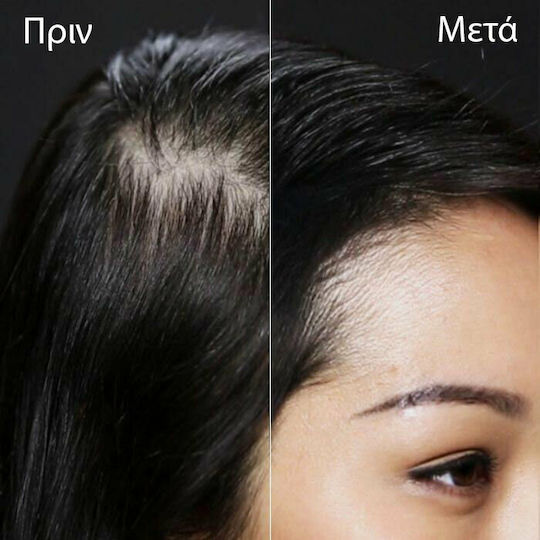 Toppik Hair Thinning Coverage Fibers with Keratin Hair Building Fibers Economy 27.5gr