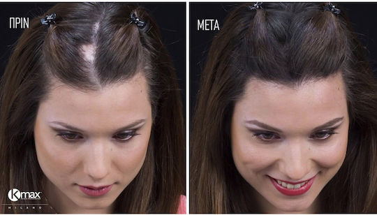Kmax Milano Hair Thinning Coverage Fibers with Keratin Travel 5gr