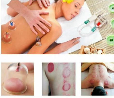 Therapeutic Device with Silicone Suction Cups Set 24pcs