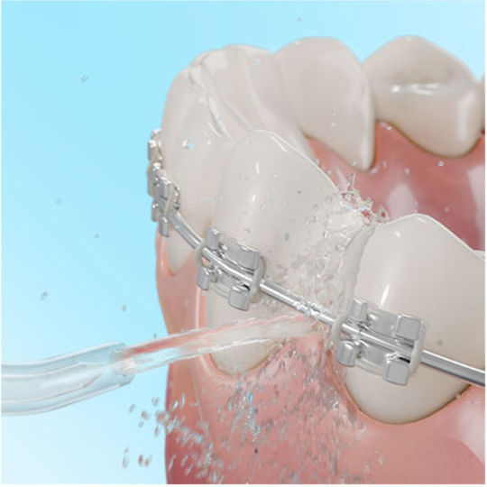 Cecotec Bamba Toothcare 1200 Jet Pro Воден Иригатор Черно