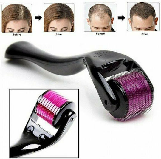 Derma Roller 540 needles 0.5mm 1τμχ