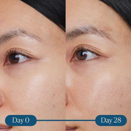Elemis Dynamic Resurfacing Super C Serum Face with Vitamin C for Radiance 30ml