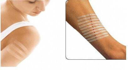 3M Steri-Strip Αυτοκόλλητα Ράμματα 100x12mm 6τμχ
