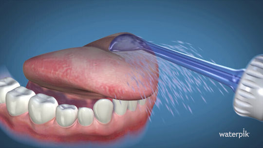 Waterpik TC-100E Ανταλλακτικά για 2τμχ