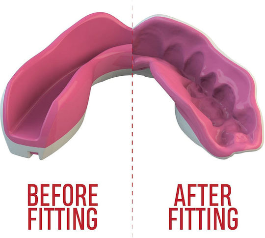 Safejawz Extro 2.0 SJFANGZPIa Protective Mouth Guard Senior White Pink Fangz