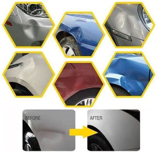Locbondso DIY Repair Kit Επιδιόρθωσης για Βαθουλώματα Αυτοκινήτου