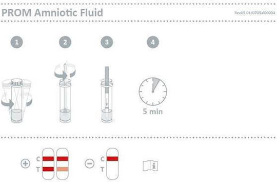 Nal Von Minden Prom Amniotic Fluid Test Strip 1pc