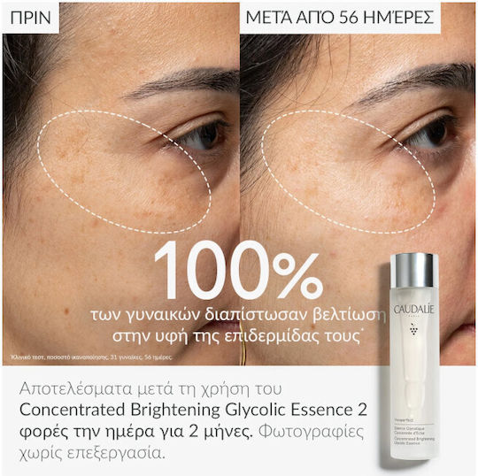 Caudalie Vinoperfect Concentrated Brightening Glycolic Essence Liquid Facial Toner for All Skin Types 100ml