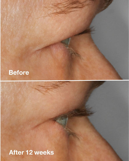 Clinique High Impact Moisturizing Serum Eyelashes with Vitamin E & Peptides for Nourishment 10ml
