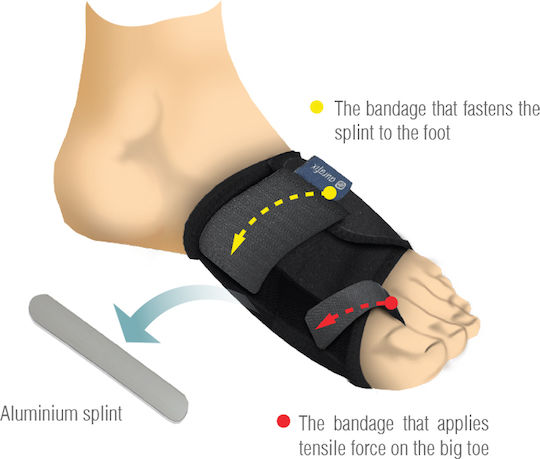 Aurafix AO-10 Left Bunion Splint Left Side