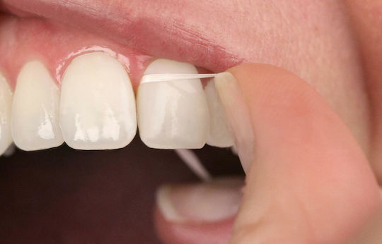 TePe Dental Tape Gewachst Zahnseide Mit Geschmack Minze 40m 1Stück