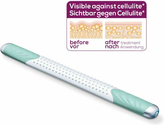 Beurer CM100 Massage Device for the Legs & the Body against Cellulite with Vibration Pink