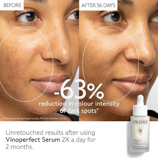 Caudalie Vinoperfect Radiance Korrektur des Teints Feuchtigkeitsspendend Serum Gesicht für Strahlkraft & Flecken 50ml
