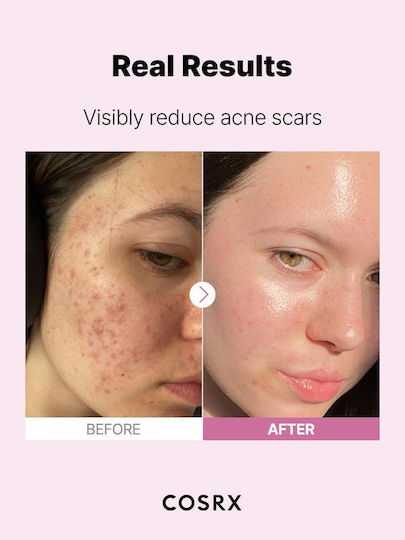 Cosrx The Niacinamide 15 Serum Προσώπου με Νιασιναμίδη για Λάμψη & Ακμή 20ml