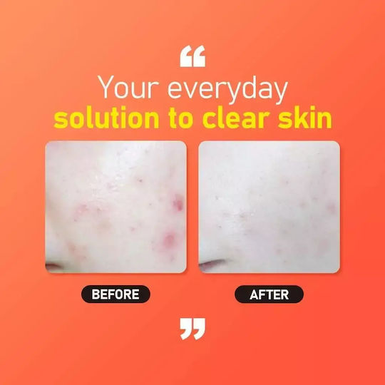 Jumiso All Day Vitamin Brightening & Balancing Facial Serum Face with Vitamin C & Niacinamide for Radiance 30ml
