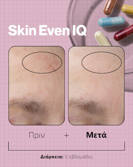 Advanced Nutrition Programme Skin Even Iq Ειδικό Συμπλήρωμα Διατροφής 140 κάψουλες