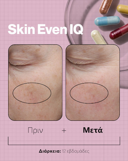Advanced Nutrition Programme Skin Even Iq Ειδικό Συμπλήρωμα Διατροφής 140 κάψουλες