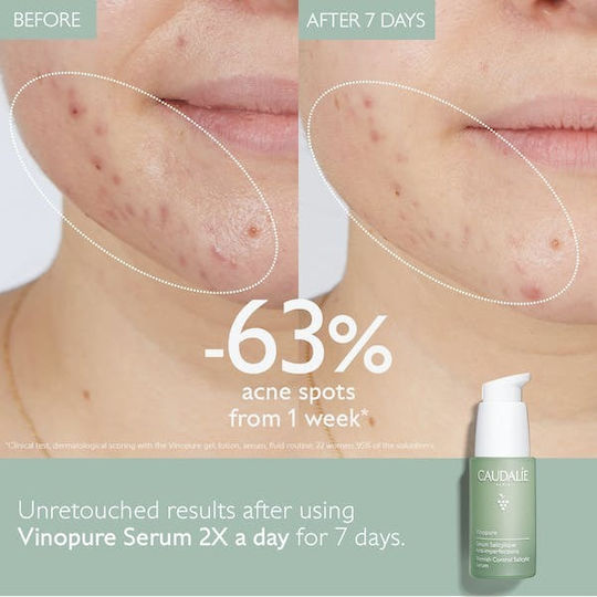 Caudalie Vinopure Blemish Control Serum Face with Niacinamide & Salicylic Acid for Radiance & Firming 30ml