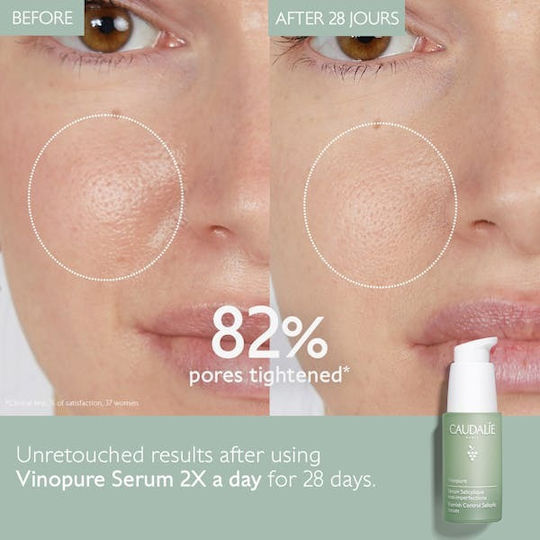 Caudalie Vinopure Blemish Control Serum Face with Niacinamide & Salicylic Acid for Radiance & Firming 30ml