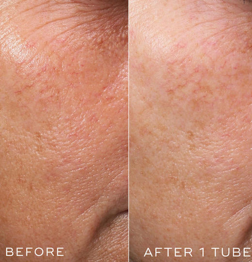 Medik8 Crystal Retinal 3 Beginner Αντιγηραντικό Serum Προσώπου με Ρετινάλη & Βιταμίνη E για Λάμψη & Σύσφιξη 30ml