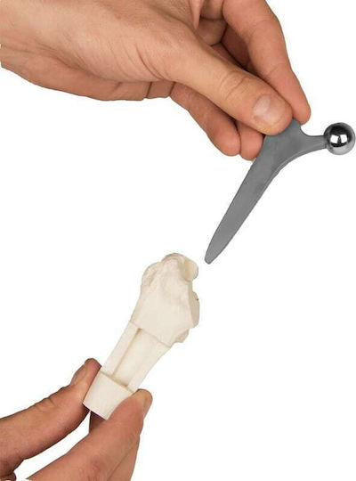 Erler Zimmer Πρόπλασμα Appendages & Joints
