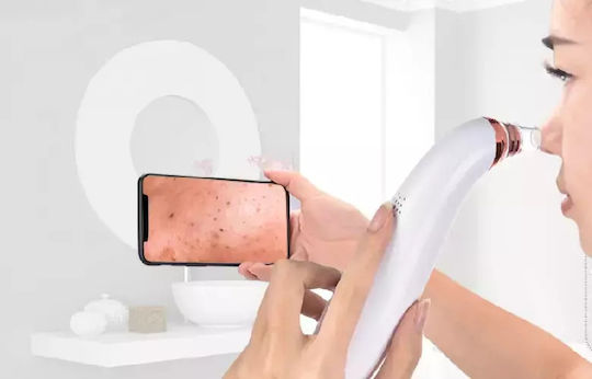 Clever FaceClean Black Spots Face Cleaning Device 090001