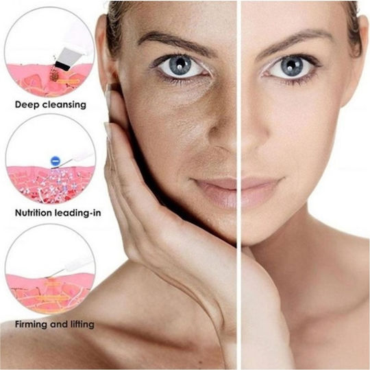 8815 Συσκευή Microneedling για Αντιγήρανση 7271