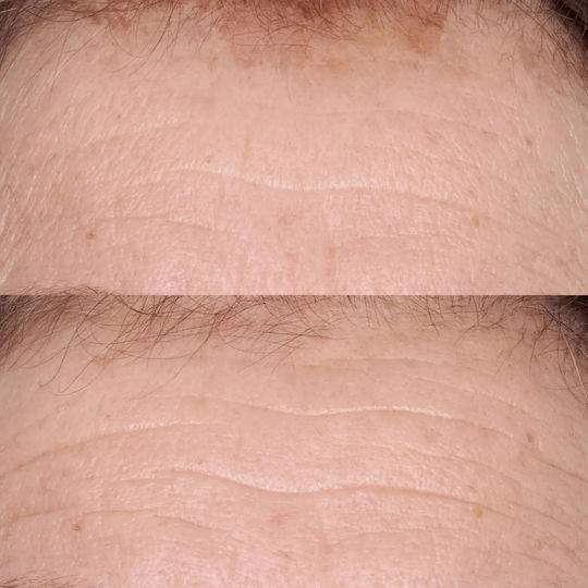 Serum de Tratament Pentru Piele Sensibilă Perricone Md Fg 2oz
