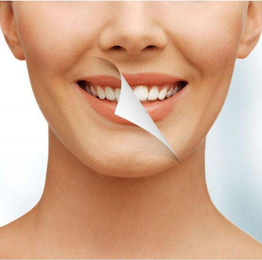 Glorysmile Whitening Химикал за избелване на зъби 2мл