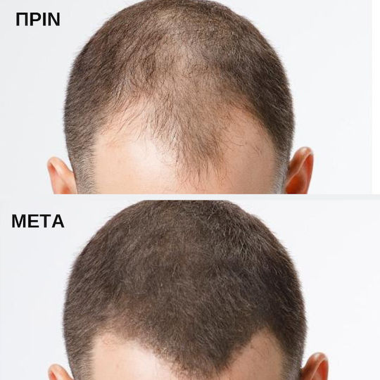 Toppik Hair Thinning Coverage Fibers with Keratin Hair Building Fibers Regular 12g