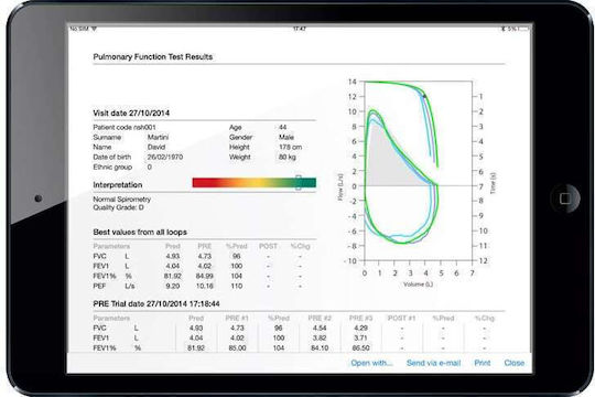 MIR Spirometru Spirobank Ii Smart