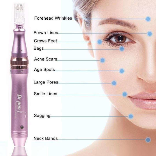 Συσκευή Microneedling για Αντιγήρανση t02115607