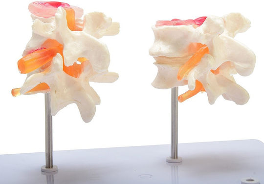 Bandscheibenmodell H139062