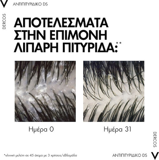 Vichy Dercos Anti Dandruff DS Sampon împotriva Mătreții și Dermatitei Seboreice pentru Păr Gras 200ml