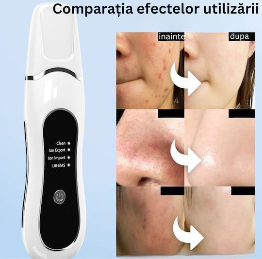 Βούρτσα Προσώπου 701405