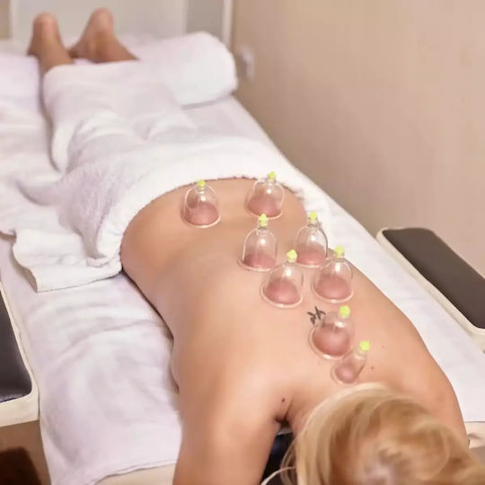 4FIZJO Suction Cups against Cellulite 12pcs