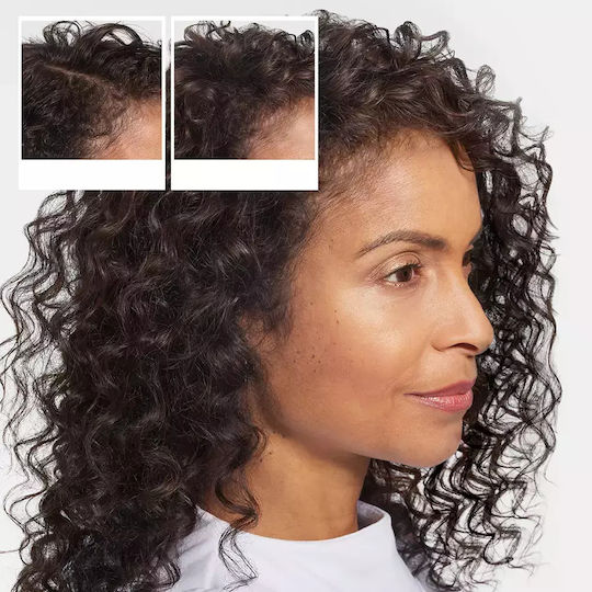 Nioxin Hair Fall Defense Σαμπουάν κατά της Τριχόπτωσης 240ml