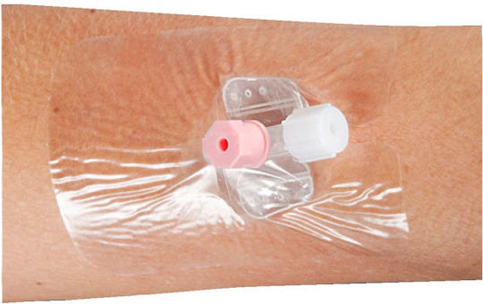 Nobamed Cateter venos Consumabile medicale 1buc